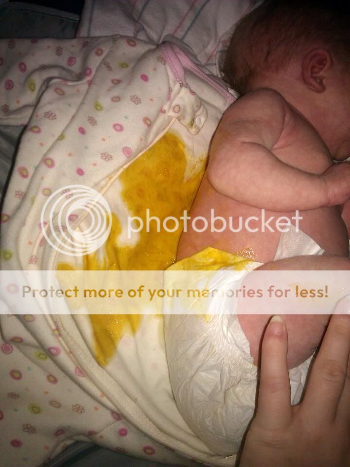 Do babies really poop up their back? Page 7 BabyCenter